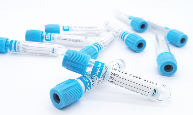 Provetta per prelievo di sangue Coagulazione Citrato di sodio 3,2% o 3,8%